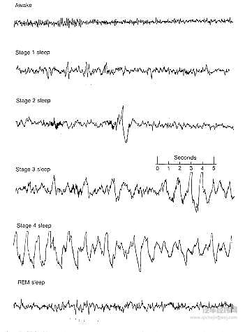 意念控制 能不能解决自动驾驶汽车爱撞车的毛病